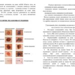 mela2019-0002